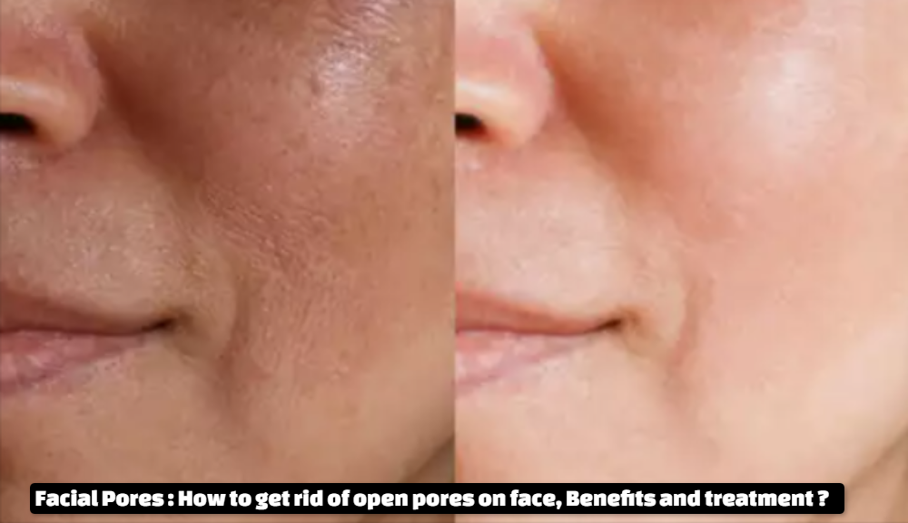 How to get rid of open pores on face