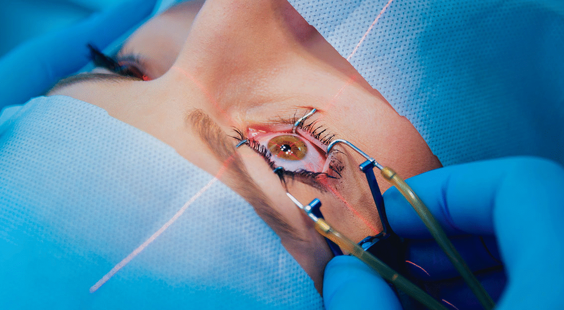LASIK Surgery Hospitals
